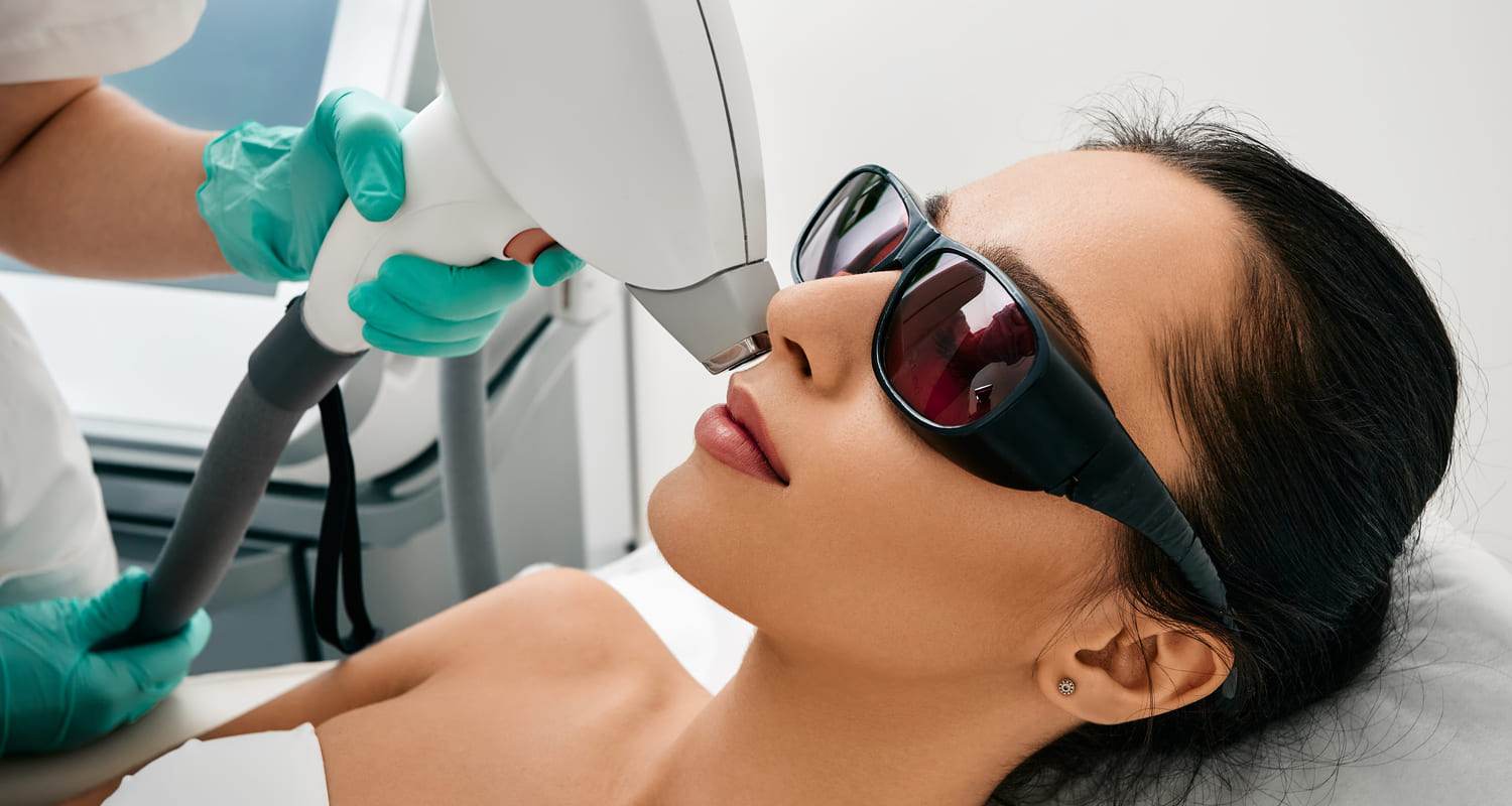 Laser Hair Removal Face