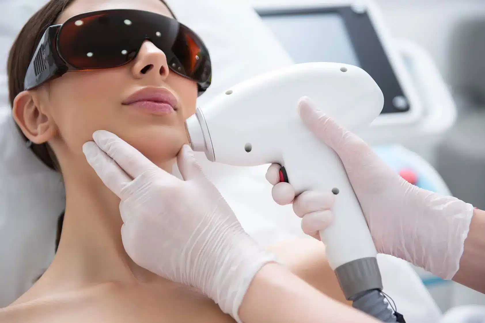 Laser hair removal chin