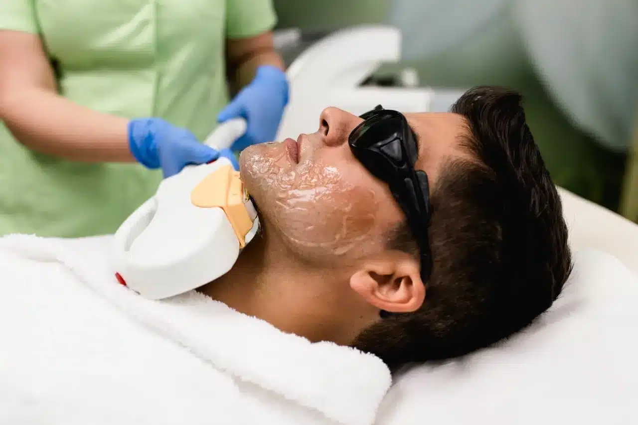 Laser hair removal for men