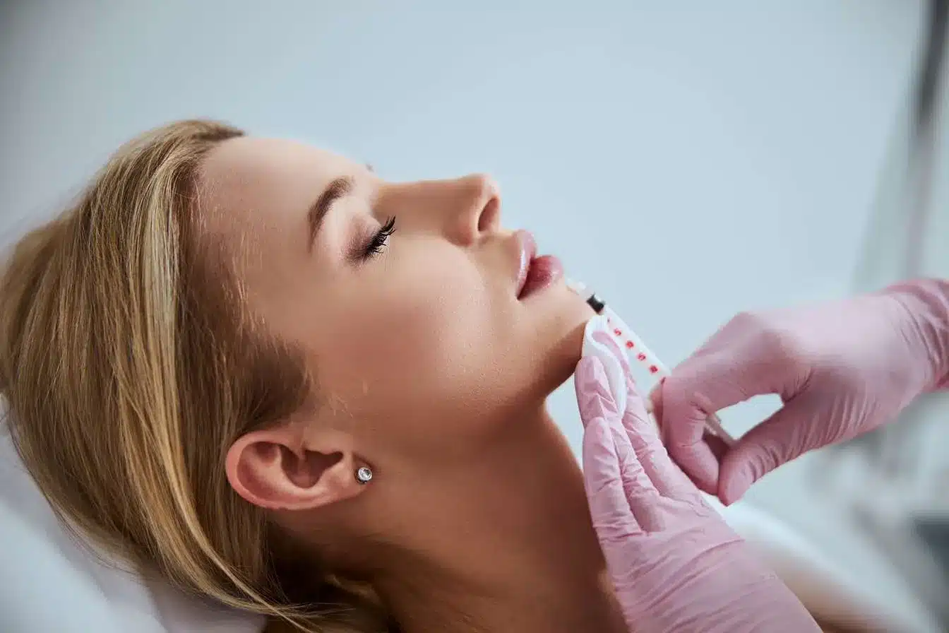 Microneedling