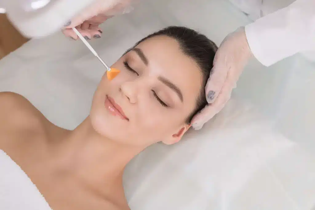 Chemical Peel by Bella Medspa Philadelphia, PA