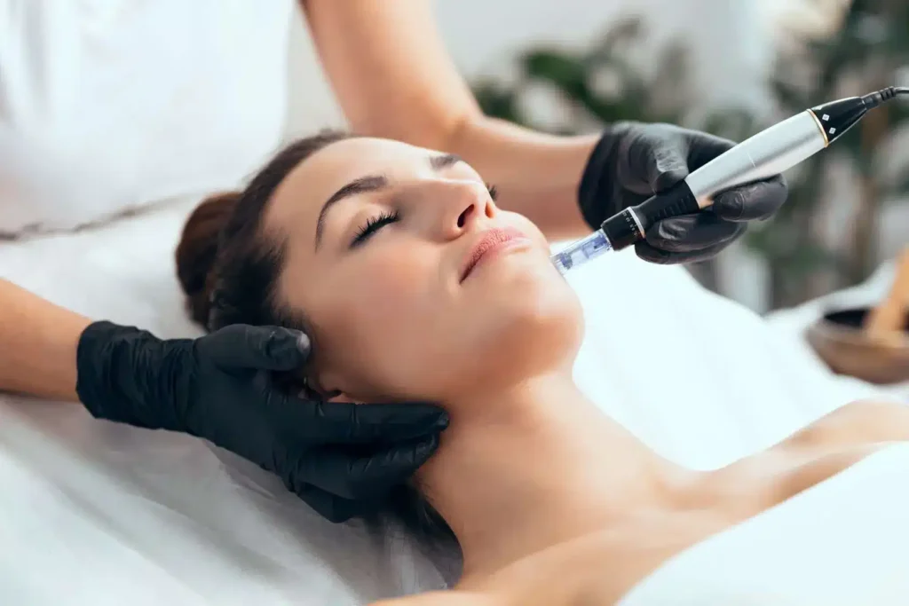 Microneedling by Bella Medspa