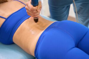 cool sculpting vs liposuction