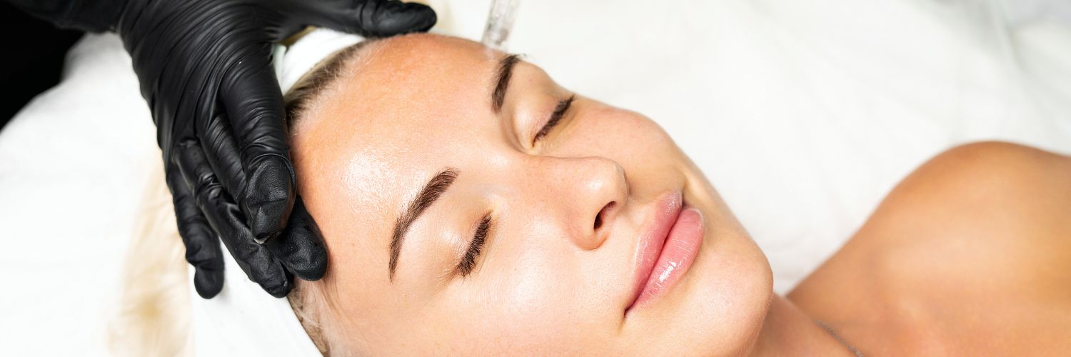 Microneedling Benefits and Process