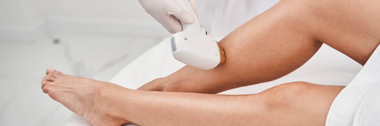 Areas for Laser Hair Removal