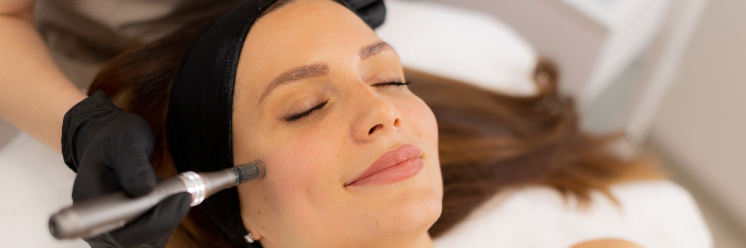 Microneedling Complete Guide