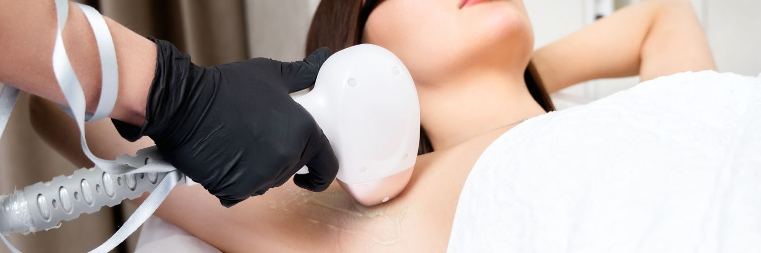 Laser Hair Removal Why Seeing a Professional Beats At-Home Devices